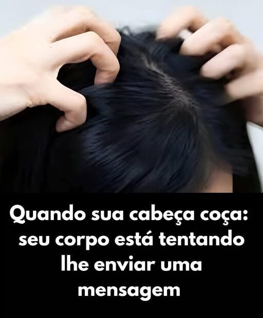 Quando Sua Cabeça Coça, Seu Corpo Pode Estar Tentando Enviar Uma Mensagem